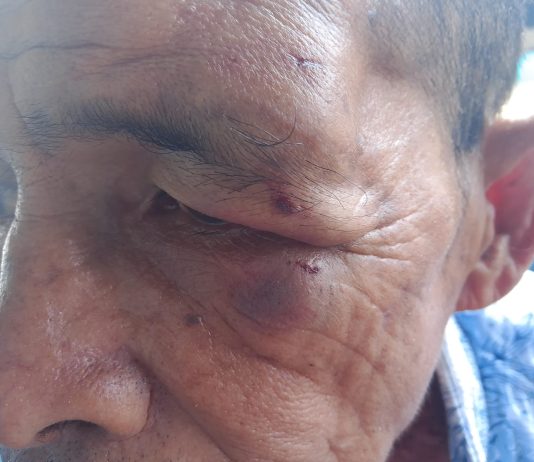 Pukul Wakil Ketua I KBPP Polri Resor Natuna, Staf Desa Ini Dipolisikan